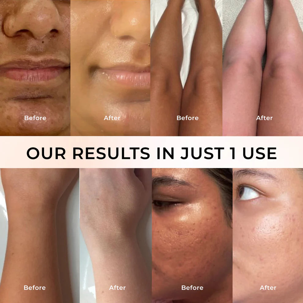 DE-Tan Skin Pack for Glowing & Radiant Skin 50gm